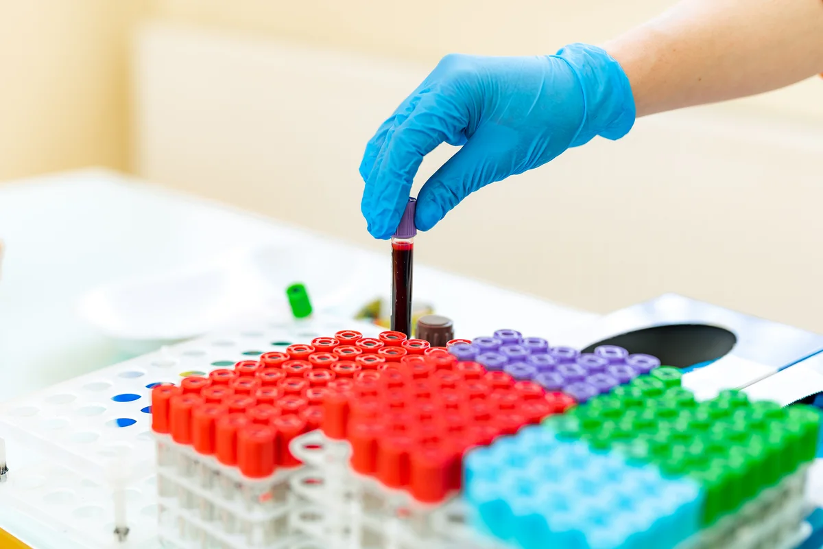 A gloved laboratory technician placing blood sample tubes into a rack of colored vials
