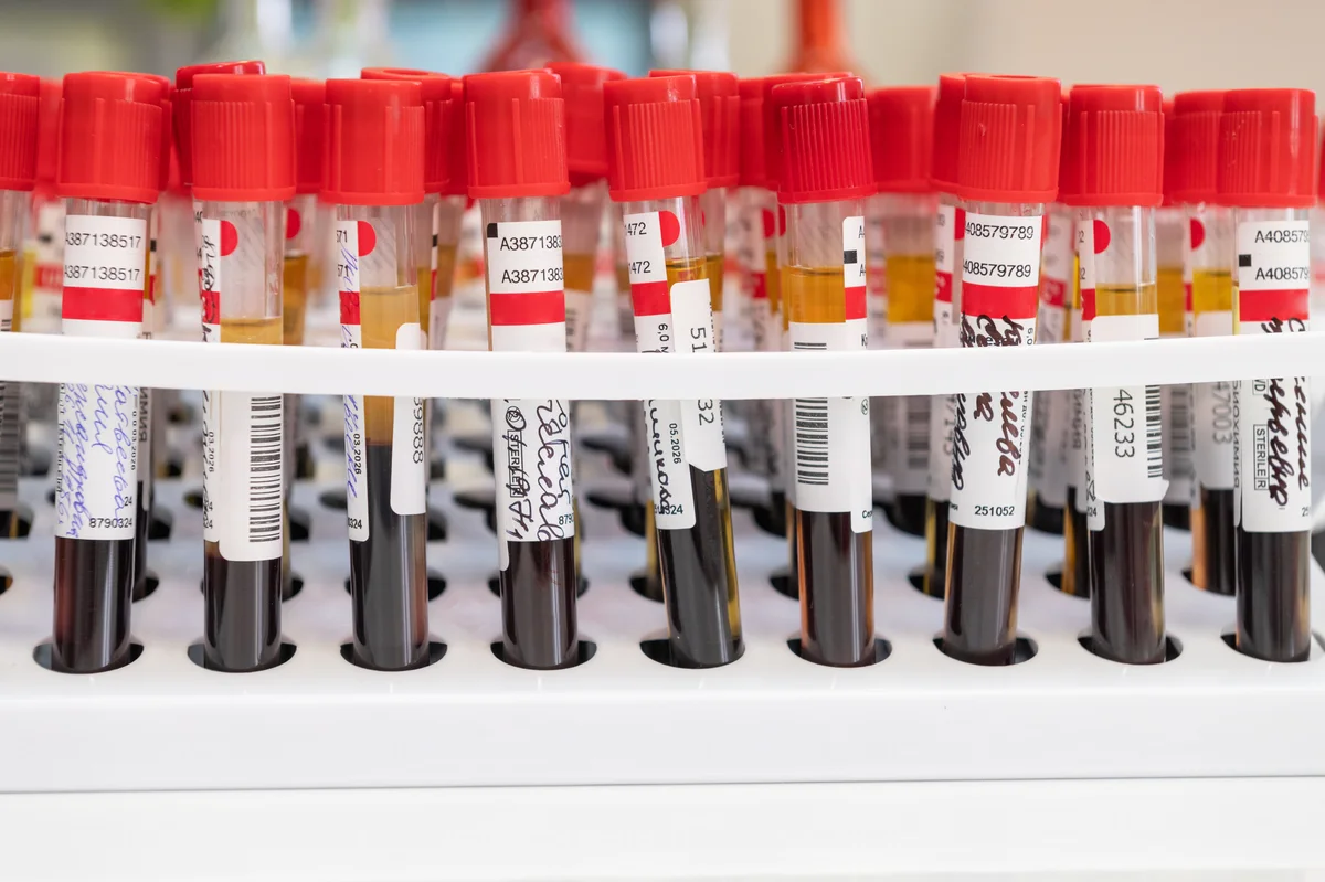 Rack of blood tubes, spun serum amber above dark cells, a printed barcode on every tube